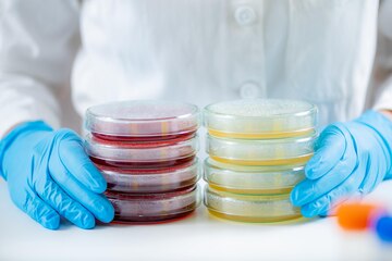 Microbial Analysis